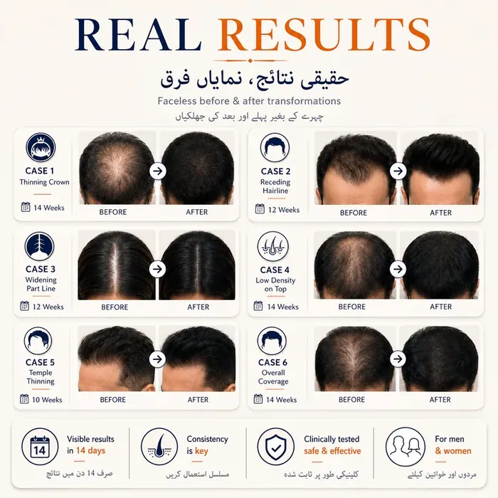 Original FEG Plus Hair Growth Serum